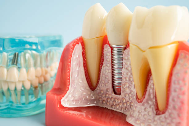 Professional  Dental Services in Medford, NY